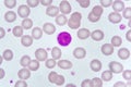 Lymphocyte cells in blood smear