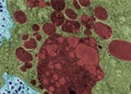 Lysosomes and lipofuscin. False colour TEM