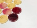 Mac Conkey agar in Petri dish, Selective isolation of Enterobacteriaceae and Escherichia coli. Isolate Gram-negative bacilli.