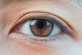 Macro asian woman brown eye with clear contact lens Royalty Free Stock Photo