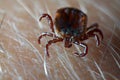 Macro close up of crawling parasitic Dermacentor reticulatus crawling on human skin.