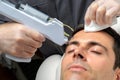 Micro needling technology used on middle aged man.