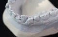 Macro close up view of plaster model of crowns of lower front teeth Royalty Free Stock Photo