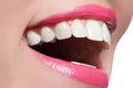 Macro happy woman`s smile with healthy white teeth, pink lips