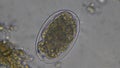 Macro Hookworm eggs parasite in stool examination