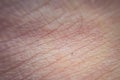 Macro of human skin texture. Dermatology pattern of healthy brown caucasian skin. Close up detail of skin Royalty Free Stock Photo