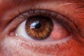 Macro image of human sad brown eye, close-up details Royalty Free Stock Photo