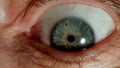 MACRO: Opened bulging human eye, Close shot