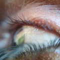 Macro photo using Mobile camera with macro lence / my friend's eye