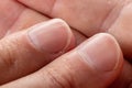 Macro photo of vertical ridges in fingernails Royalty Free Stock Photo