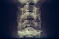 Macro photo of X-Ray film of human neck