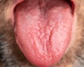 Macro shot of a man`s geographic tongue.