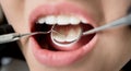 Macro shot of young woman having dental check up in dental clinic. Dentist examining a patient`s teeth with dental tools