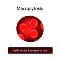 Macrocytes. Red blood cells are increased in size. Vector illustration on isolated background Royalty Free Stock Photo