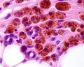 Macrophages