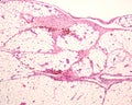 Macrophages. Peritoneal fat