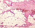 Macrophages. Peritoneal fat