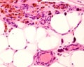 Macrophages. Peritoneal fat