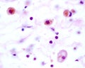 Macrophages