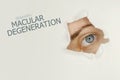 Macular degeneration disease poster with eye test chart and blue eye.