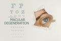 Macular degeneration disease poster with eye test chart and blue eye.