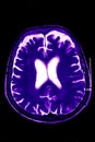Magnetic Resonance of Brain, blue Royalty Free Stock Photo