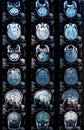 Magnetic resonance image MRI of the brain Royalty Free Stock Photo