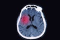 Magnetic resonance image (MRI) of the brain Royalty Free Stock Photo