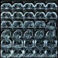 Magnetic resonance images