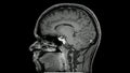 Magnetic resonance images of the brain MRI brain sagittal post contrast sequence