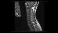 Magnetic Resonance images of Cervical spine sagittal T1-weighted images  MRI Cervical spine Royalty Free Stock Photo