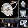 CT scans of human head