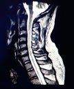 Magnetic resonance scan of the cervical spine. Royalty Free Stock Photo