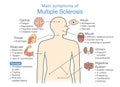 Main symptoms of Multiple Sclerosis. Royalty Free Stock Photo