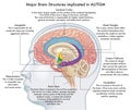 Major human brain structures implicated in autism