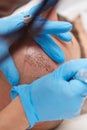 Making permanent make up tricopigmentation