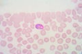 Malaria blood smear pictures
