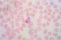 Malaria blood smear pictures