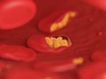 Malaria infected blood cells