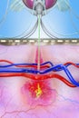 A malaria-infected mosquito transmits malaria pathogens to the human bloodstream during mosquito bites