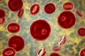 The malaria-infected red blood cell Royalty Free Stock Photo