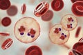 The malaria-infected red blood cells