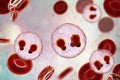 The malaria-infected red blood cells