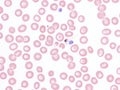 Gametocyte of Plasmodium falciparum in peripheral blood.