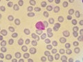 Malaria parasite