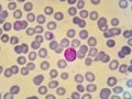 Malaria parasite