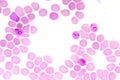 Malaria parasite in red blood cells