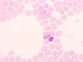 Malaria parasite in red blood cells