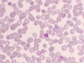 Malaria parasite in red blood cells