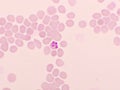 Malaria parasite in red blood cells